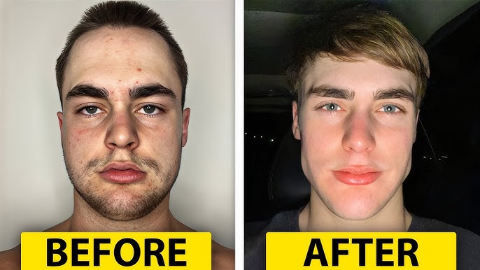 Looksmaxxing: Η νέα εμμονή της «υπερ-αρρενωπότητας», η βιομηχανία της ανδρικής ανασφάλειας και η σύνδεση με τον Ακροδεξιό ριζοσπαστισμό